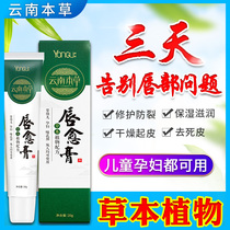  Lip care cheilitis lipstick repair rotten corners of the mouth Lips chapped peeling foaming Special medicine Cheilitis Kang children