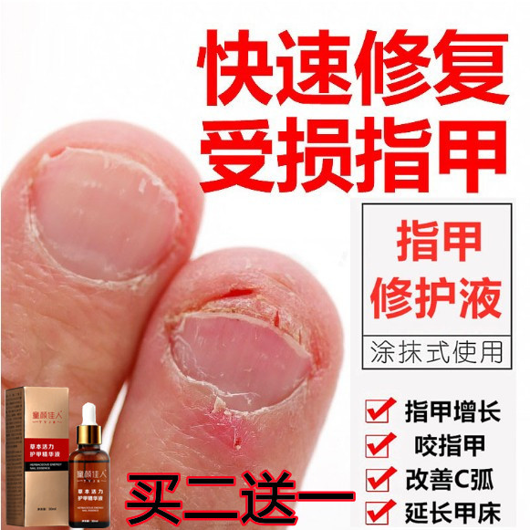 Nail Repair Nail Bed Repair Growth Solution Improves C-Curve Nail Growth, Nourishes the Nail Bed, Protects the Nails, and Promotes Nail Growth Nail Repair Nail Bed Repair Growth Solution Improves C-Curve Nail Growth, Nourishes the Nail Bed, Protects the Nails, and Promotes Nail Growth