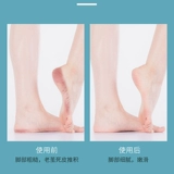 曙兴 Электрический скутер заряжает автоматические шкуры для ног до мертвой кожи, вызывая Calluses, Scoop Swords, Формирование машинных артефактов