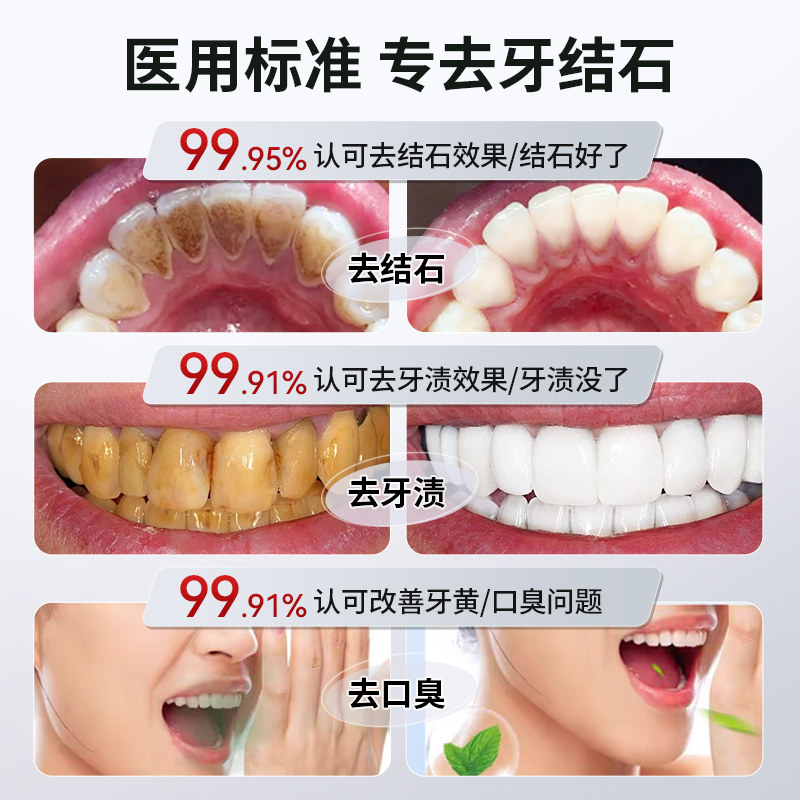 ✨高露洁牙膏大起底！拯救口腔健康的神器来了，家人们快收藏！