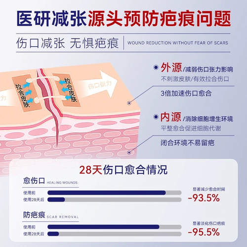 Уменьшите шрамы по размещению размещения для кесарева сечения.