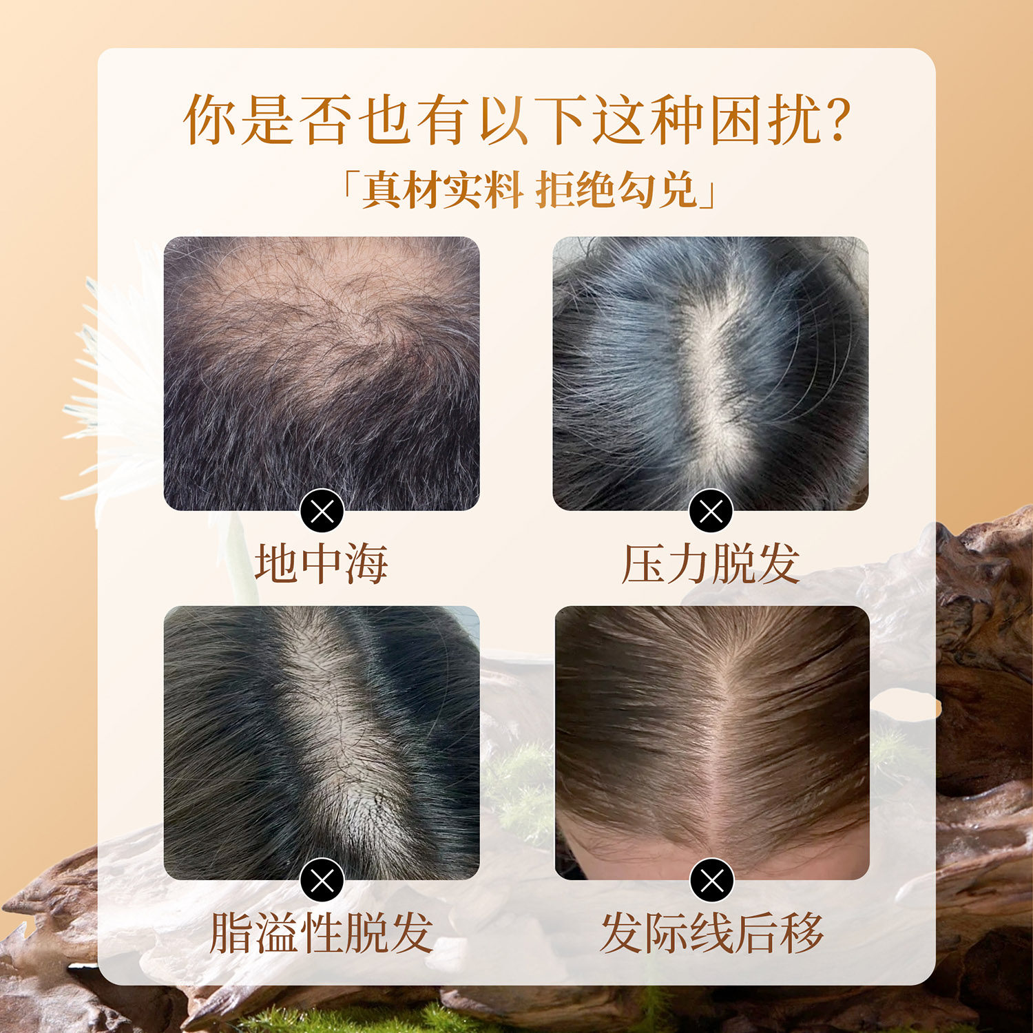 侧柏叶洗发皂真的能防脱生发吗?2025年实测效果与使用指南_头发护理_淘宝美妆网