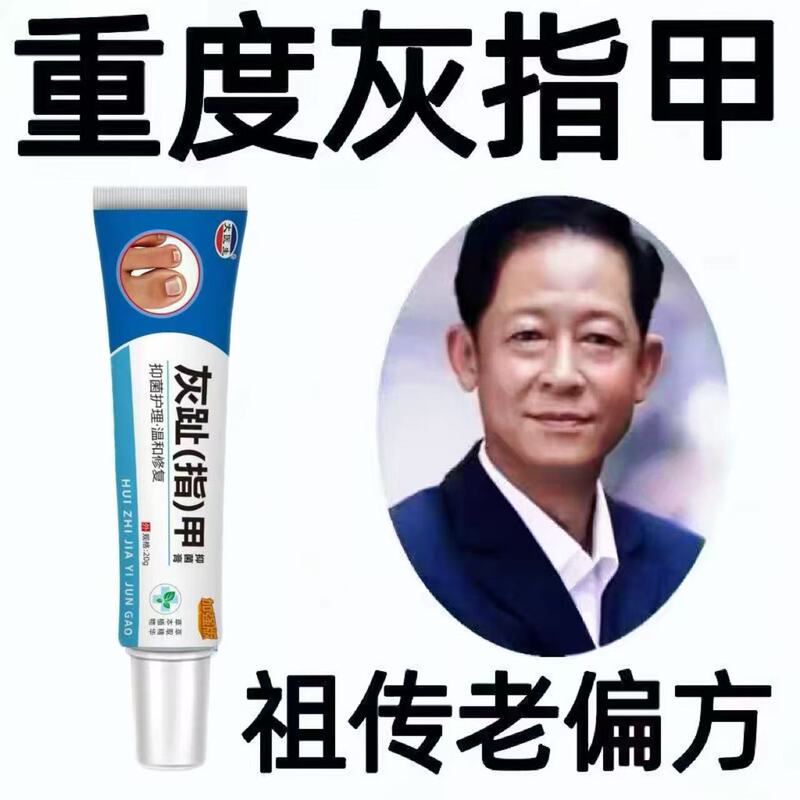 【Official Genuine Product】Gray Toe Thickening Genuine Specialized Nail Fungus Cream for Yellowing and Damaged Nails, Specially for Toenails and Fingernails 【Official Genuine Product】Gray Toe Thickening Genuine Specialized Nail Fungus Cream for Yellowing and Damaged Nails, Specially for Toenails and Fingernails