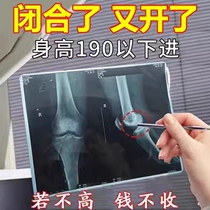 Growth stickers for children Young adults Long high post non-hormone fueling post-Heightened External Foot Stick bodybuilding Applier