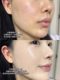 Korean Fau Air Cushion Regenerating and Repairing Bb Cream Moisturizing Foundation Liquid Concealer Brightening Skin Tone Star Air Cushion with Refill