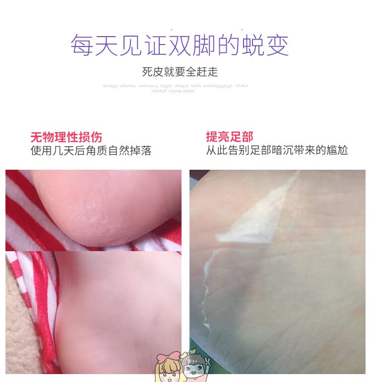 Nhật Bản MiiMeow Mi một bộ phim chân chăm sóc cho người chết da già chân mềm gót chân bong tróc chân sừng cao dán gan bàn chân thải độc