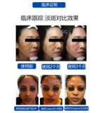 Сингапурская клиника Direct RMB | Cyspera Herne Catsseamine White Cream Upderved Version Ярко -белый класс