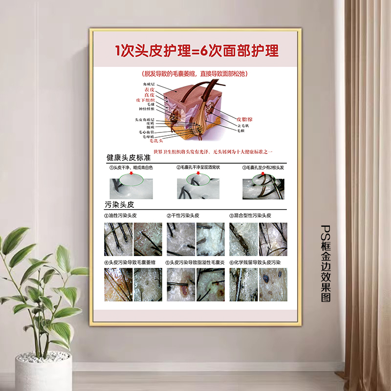 Scalp Hair Follicle Detection Images, Hair Growth and Hair Care Posters, Promotional Posters, Hair Structure Diagrams, Hair Loss Level Charts, Wall Art Scalp Hair Follicle Detection Images, Hair Growth and Hair Care Posters, Promotional Posters, Hair Structure Diagrams, Hair Loss Level Charts, Wall Art