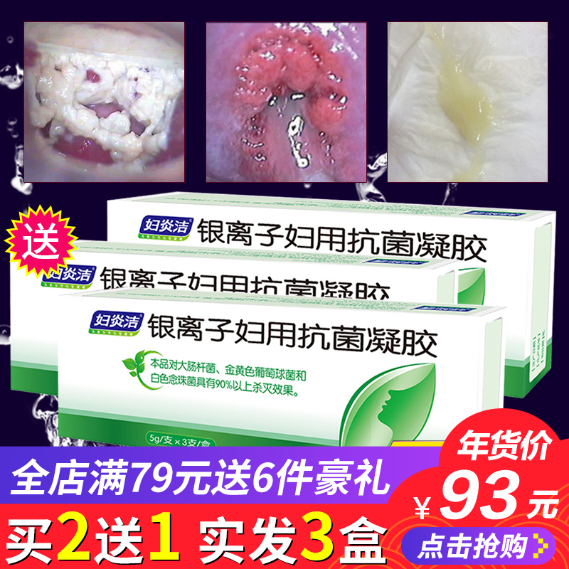 妇炎洁银离子妇用抗菌凝胶型抑菌私处护理霉菌性阴道炎症洗液女性