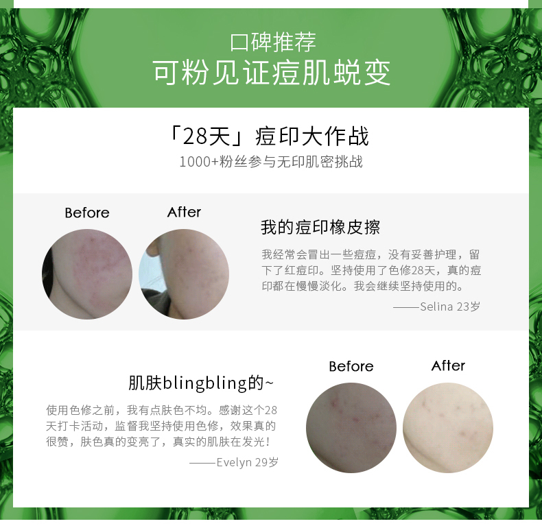 丽 可 Làm dịu và làm sáng các vết mụn trứng cá Duke trồng sửa chữa màu sắc để cải thiện làn da đỏ và sáng da serum madagascar