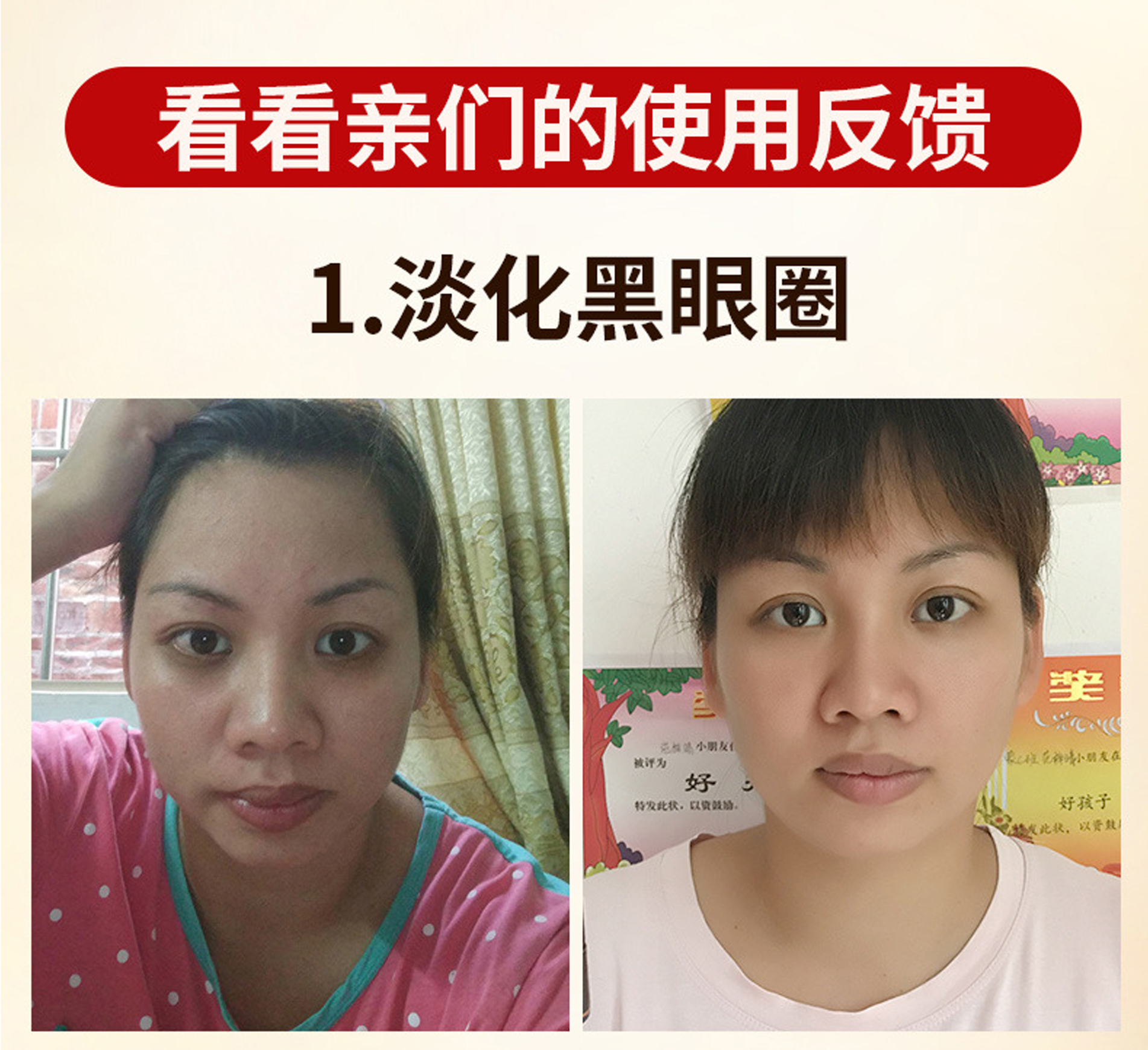 2018 Snake Eye Cream to Dark Circles Lightening Kháng Fine Wrinkle So nhẹ Eye Care Cream Eye Mask Eye 30g cây lăn mắt