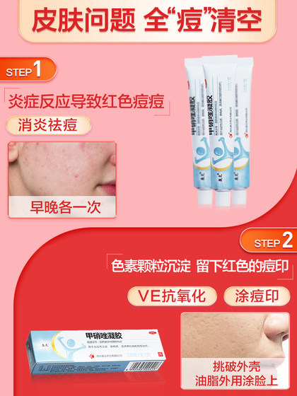 clotrimazole cream for rosacea