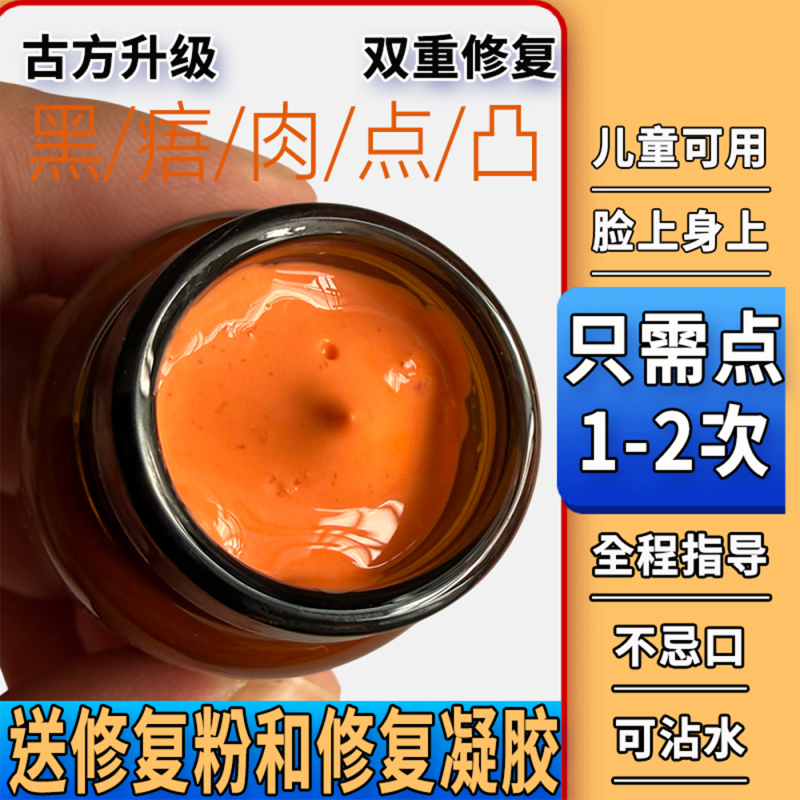 Facial Spot Remover Cream, Genuine Freckle Remover, Removes Dark Spots and Moles on the Face Without Leaving Scars, Beauty Salon Special Tool Facial Spot Remover Cream, Genuine Freckle Remover, Removes Dark Spots and Moles on the Face Without Leaving Scars, Beauty Salon Special Tool