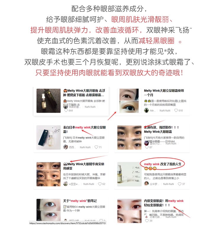 Chen Zimi Nhật Bản Melty Wink Mắt Eye Essence Kem Dưỡng Mắt Làm Săn Chắc Giữ Ẩm Chăm Sóc Mắt