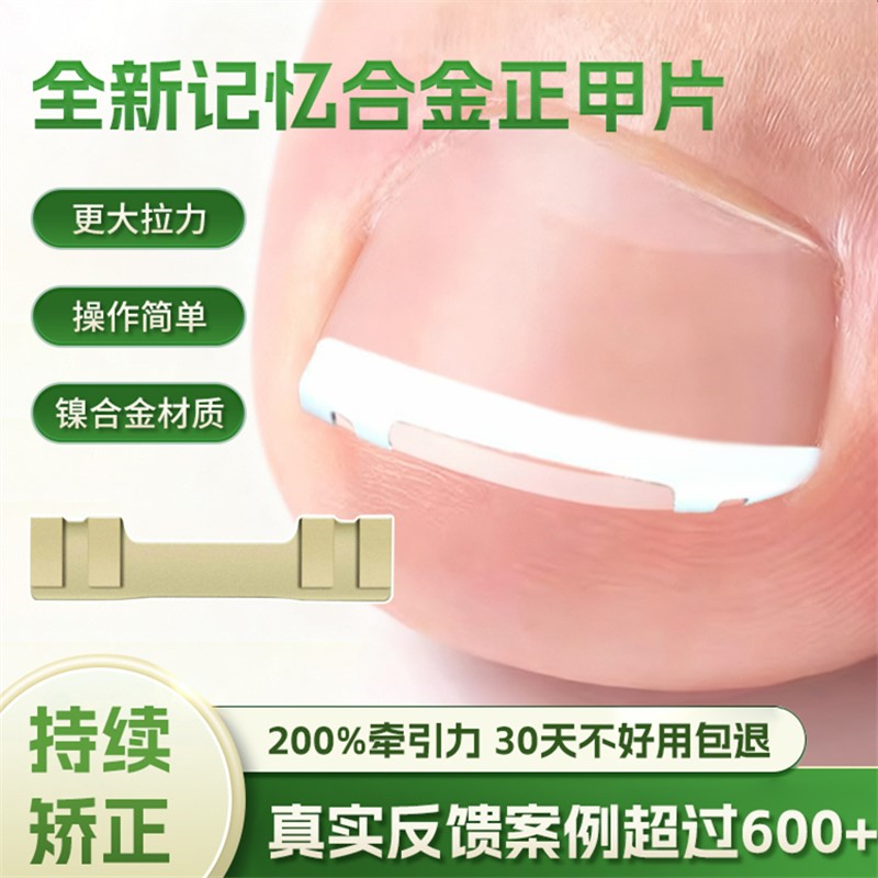 Ingrown Toenail Corrector, Ingrown Toenail Correction Device, Ingrown Toenail Auxiliary Tool, Nail Straightening Tool, Nail Curling Tool