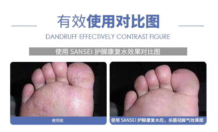 nước tẩy bồn cầu vim Khử mùi giày Sock xịt khử trùng chân ngứa chân nước hoa thơm mùi vị của gia đình - Trang chủ tay bon cau