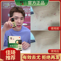 Wart must cure official flagship store clear wart cream to remove the small fleshy filamentous wart artifact thorn monkey meat wart on the neck