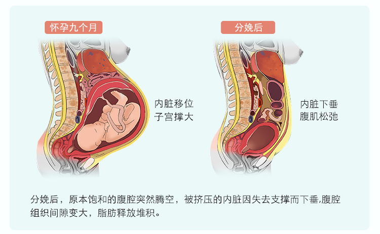 Vành đai bụng sau sinh mổ lấy thai để sản xuất cơ thể hình thành quần áo bụng giảm béo phần mỏng bụng corset dây đai bốn mùa phổ