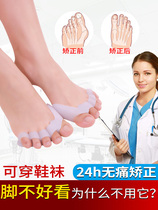 Big Mother Toe Large Foot Bone Thumb Valgus Straightener Small Toe Flexion Correction Instrumental Male Lady Silicone Toe