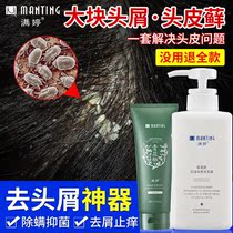 Manting amino acid shampoo scalp cleaning mite removal mites removal of mites and anti-itching oil fluffy official flagship store