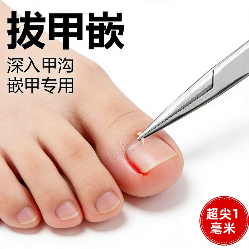 【First Order Discount】Steel Ingrown Nail Tweezers, Extra Sharp Nail Clippers for Care of Nail Grooves and Ingrown Nails, Foot Care