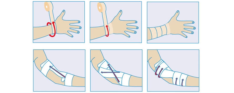 Protection sport - Ref 586165 Image 15