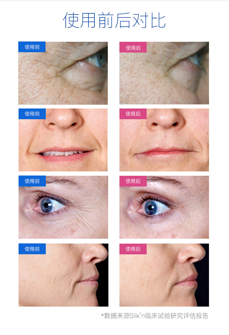 金盒特价 Silk'n Face Tite 三源射频美容仪 中亚Prime会员免运费直邮到手约￥1043