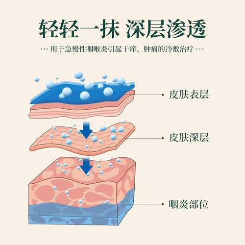 康护堂 Апрей с болью в горле, горло и горло вызывает сухое горло, сухое кашель глотка жидкости, горло, неудобное и острый хронический фарингит