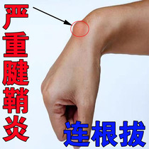 (一贴包好)腱鞘炎手腕专用贴护腕疼痛消除贴膏囊肿大拇指关节贴