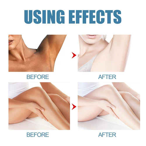 Кремы для тела отбеливающие кремовые кремы