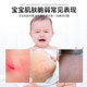 Children's herbal skin care cream 20g baby baby children's moisturizing skin care body care cream antipruritic cream