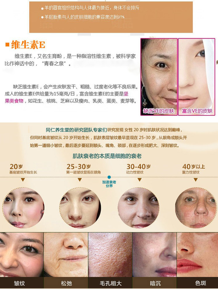 Bảo vệ tử cung và buồng trứng duy trì viên nang mềm đa nang điều hòa kinh nguyệt điều hòa rối loạn điều chỉnh trì hoãn ít sản phẩm chăm sóc sức khỏe - Thực phẩm dinh dưỡng trong nước viên uống bổ sung