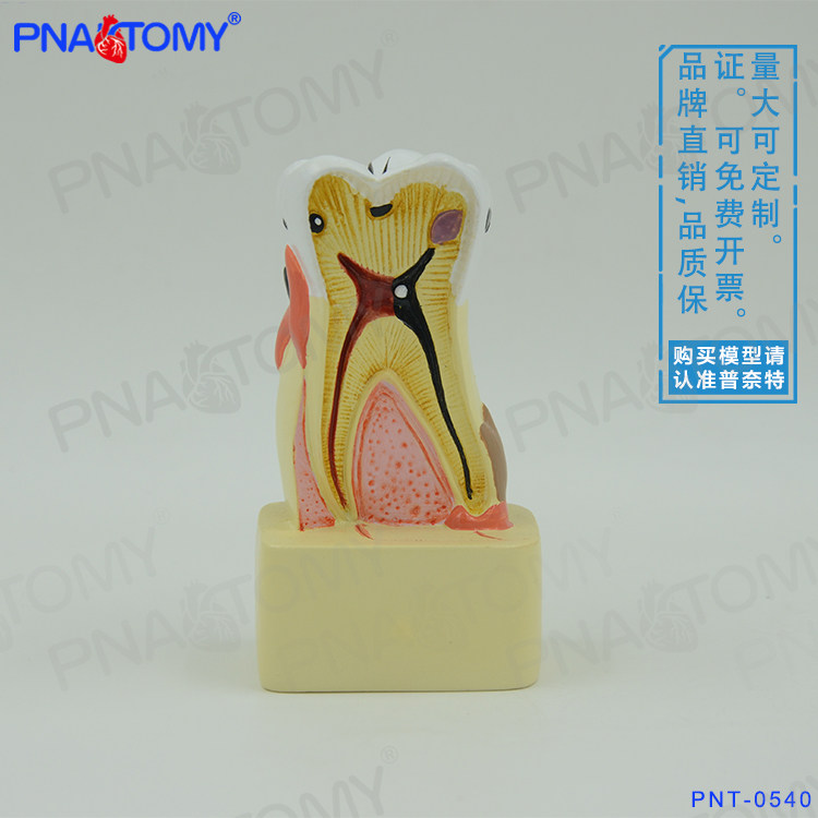 牙齿模型幼儿园口腔教学玩具牙科医用教学口腔科病理医患沟通