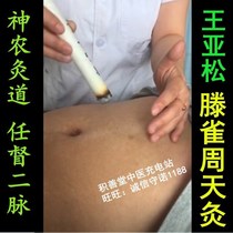 Wang Yasong Teng Zhou Tian Moxibustion Shennong Moxibustion Dao Ren Du Ermai Zhou Tian Moxibustion (Jishantang) moxibustion training 24g