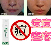 Acne removal for chest acne scars wine pimples for pimples instant acne removal and removal of pimples and fat particles on the back acne flattening