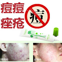 Plant facial sores and wine thorns can remove closed acne on the forehead adolescent acne can be removed and pimple marks on the chest can be removed.