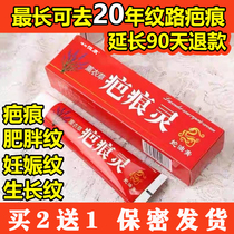 Scar surgery for scar scar cream scar scar cream scar repair scar convex scar repair