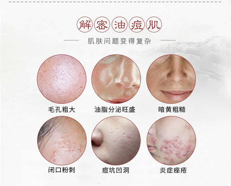 Một miếng băng trị mụn rõ ràng Qingtang 12 miếng để làm sáng các vết mụn làm mới kiểm soát mặt nạ dưỡng ẩm dán mặt nạ chính hãng - Mặt nạ kem dưỡng trắng da mặt cho da dầu