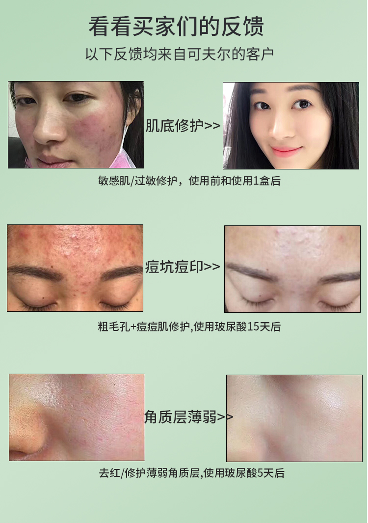 Đức kefuer kefir hyaluronic acid giữ ẩm da mặt làm săn chắc tinh chất 30 serum cá hồi