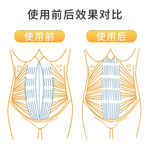 费莱欧 Послеродовой бондаж для беременных, для салонов красоты