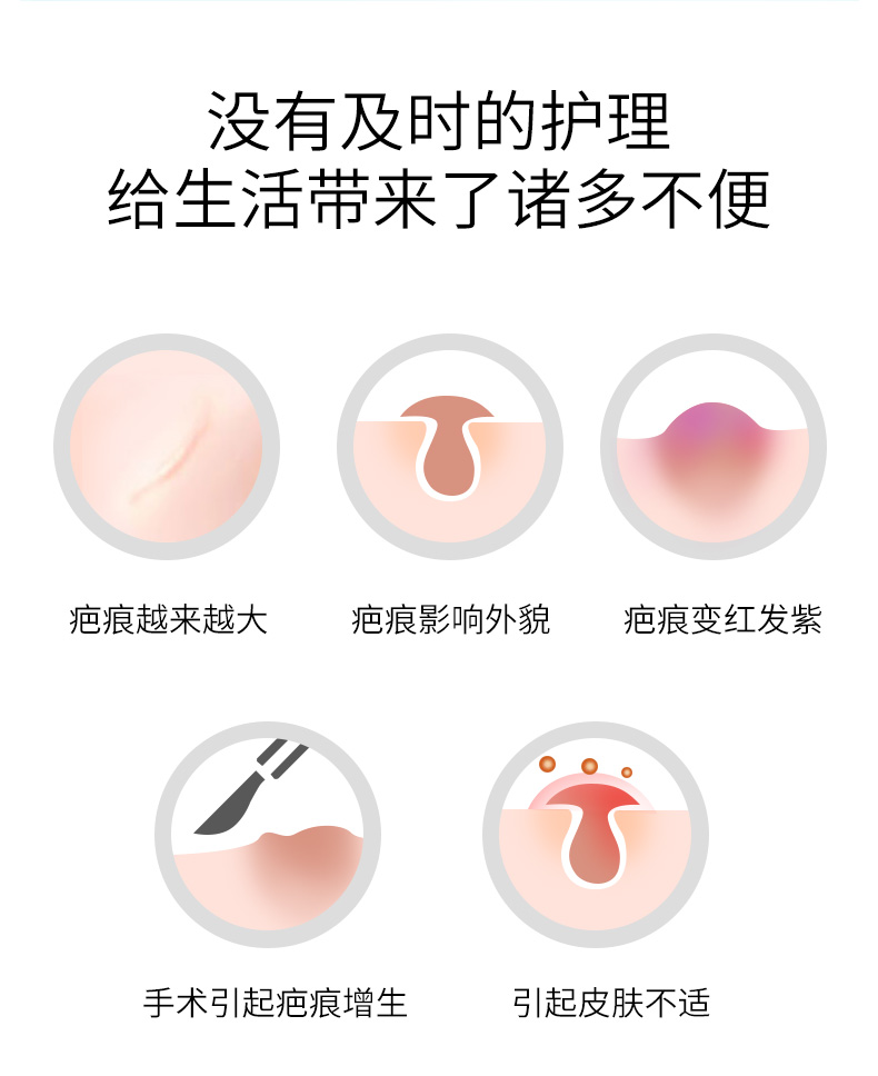 振德 医用硅酮凝胶敷料 医用祛疤膏 20g 图2