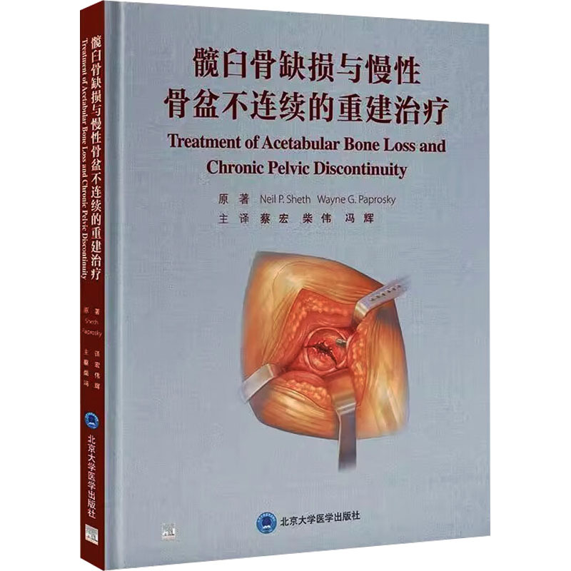 [Original Edition] 9787565932434 Reconstruction and Treatment of Acetabular Bone Defects and Chronic Pelvic Discontinuity [Us] Neil Seth, Peking University Medical Press