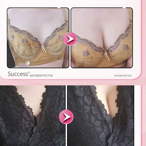 Послеродовые разглаживающие расслабляющие наклейки на соски для здоровья груди, эластичный увеличивающий крем, наружное применение