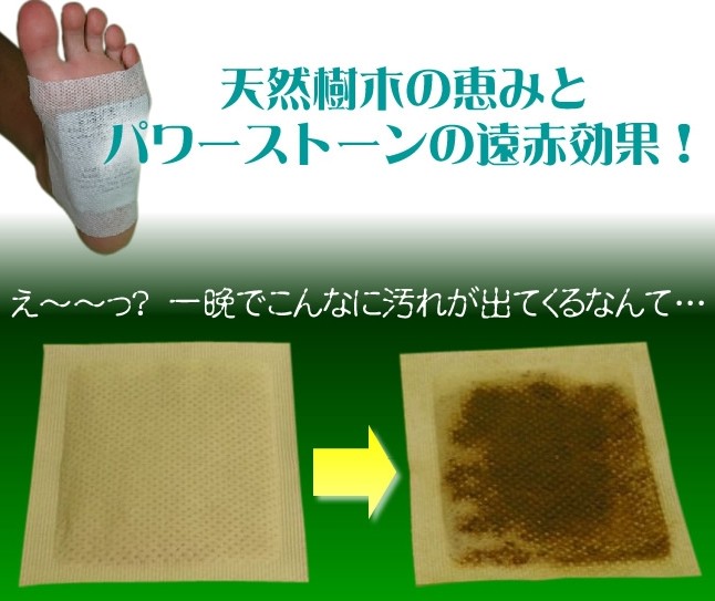 Nhật Bản tự nhiên Bashi Han Fang chân gậy ẩm ướt và giảm chất béo phù nề để ướt chăm sóc bàn chân dán kem trị nứt gót chân hàn quốc