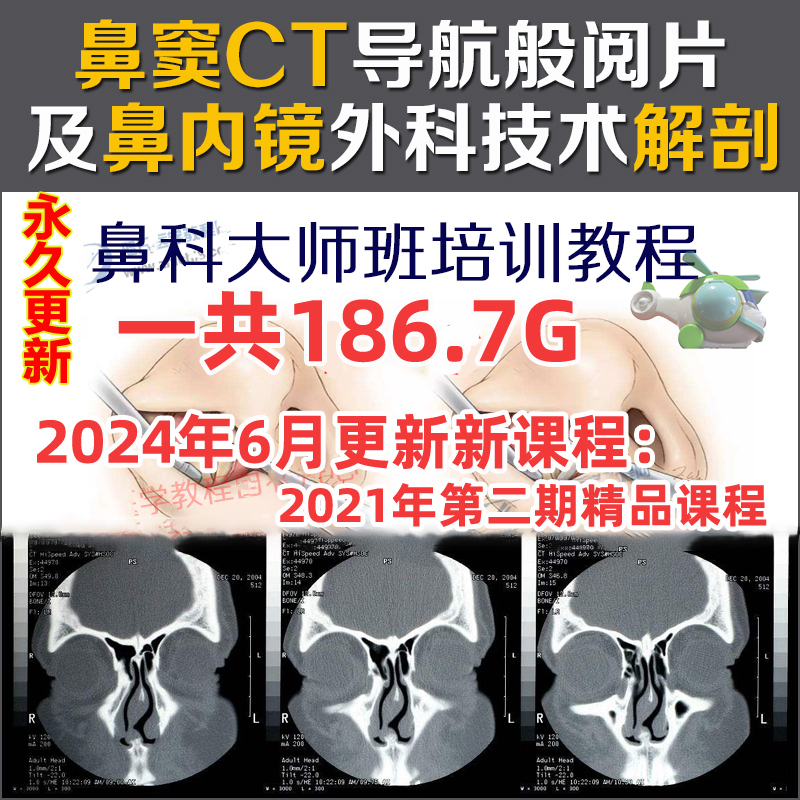 Wu Yanqiao's Ct-Guided Sinus Review and Nasal Endoscopy Surgery Anatomy Training Video Tutorial, Rhinology Master Class