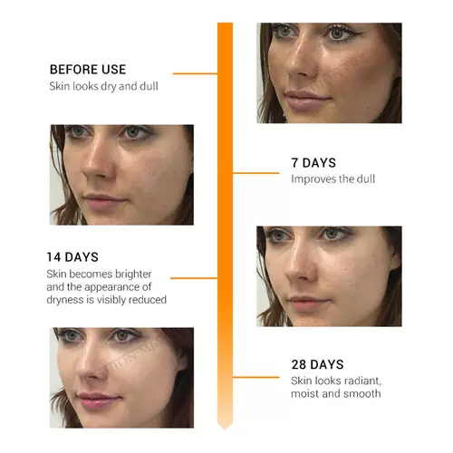 [10pc BB Cream Glow Foundation Korean Cosmetics MesoWhite]