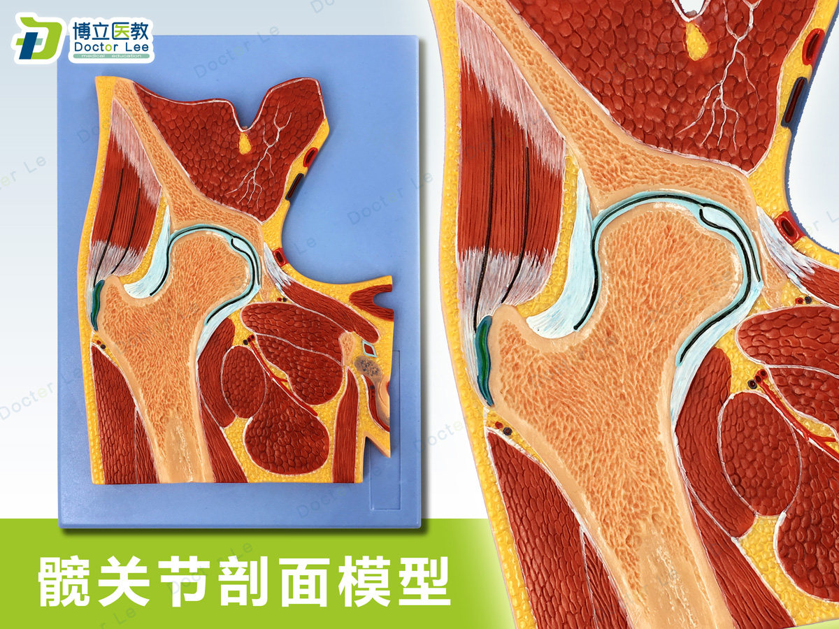 人体断层扫描 髋关节切面 浮雕 髋关节断层解剖学模型 ct