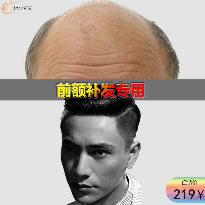 前额脱发男士假发片 头顶补发片真发 发顶补发块无痕隐形自然背头