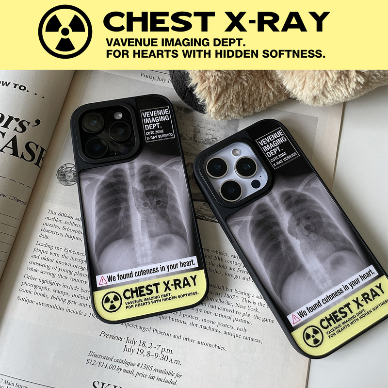 Va Victory Avenue X-Ray Ct Scan Kitten and Puppy Image Transformation Phone Case Suitable for Apple 15 iPhone 16 Pro Max, Dynamic Black Personalized ins Fengyuan Creative Design Va Victory Avenue X-Ray Ct Scan Kitten and Puppy Image Transformation Phone Case Suitable for Apple 15 iPhone 16 Pro Max, Dynamic Black Personalized ins Fengyuan Creative Design