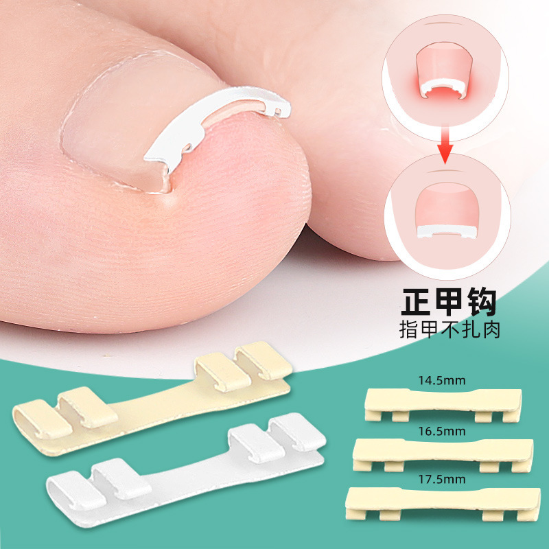Nickel-Titanium Alloy Ingrown Toenail Hook, Physical Stretching of Nail Groove, Correction of Ingrown Toenails, Compact and Invisible, Can Be Worn with Shoes and Allows for Walking Nickel-Titanium Alloy Ingrown Toenail Hook, Physical Stretching of Nail Groove, Correction of Ingrown Toenails, Compact and Invisible, Can Be Worn with Shoes and Allows for Walking